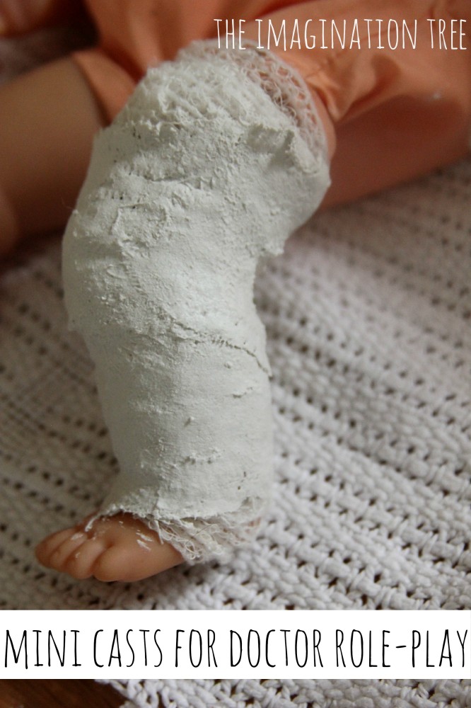 Real plaster casts for doctor role play